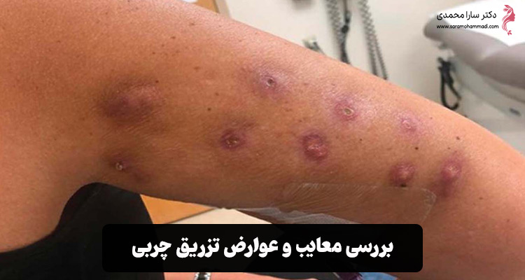 معایب و عوارض تزریق چربی