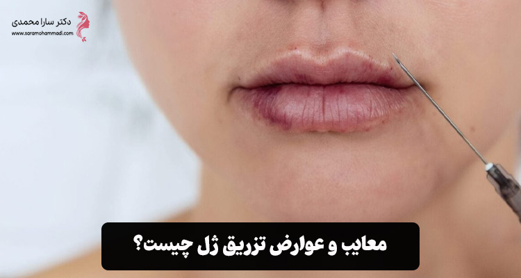 معایب و عوارض تزریق ژل