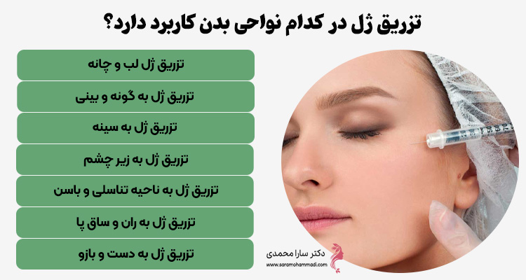 بررسی کاربردهای تزریق ژل