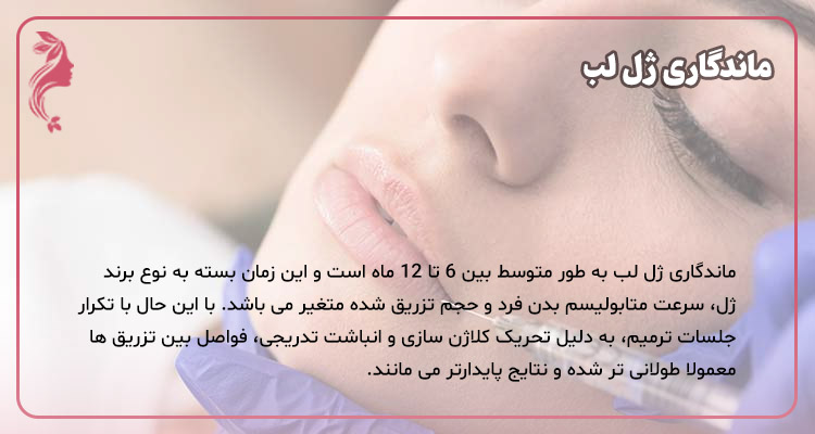 ماندگاری ژل لب