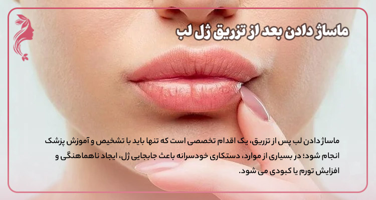آیا ماساژ دادن لب بعد از تزریق لازم است؟