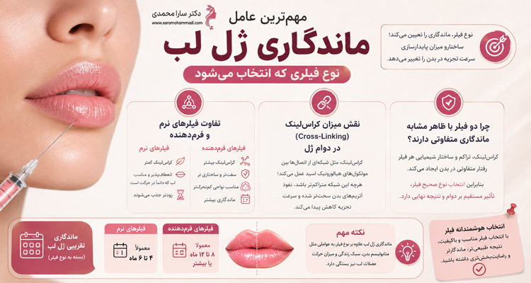 نوع فیلر، مهم‌ترین عامل ماندگاری ژل لب
