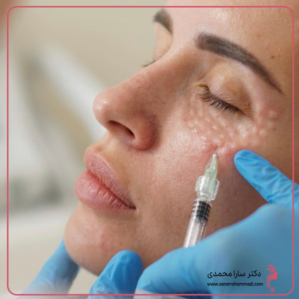 عوارض جانبی تزریق مزوژل زیر چشم