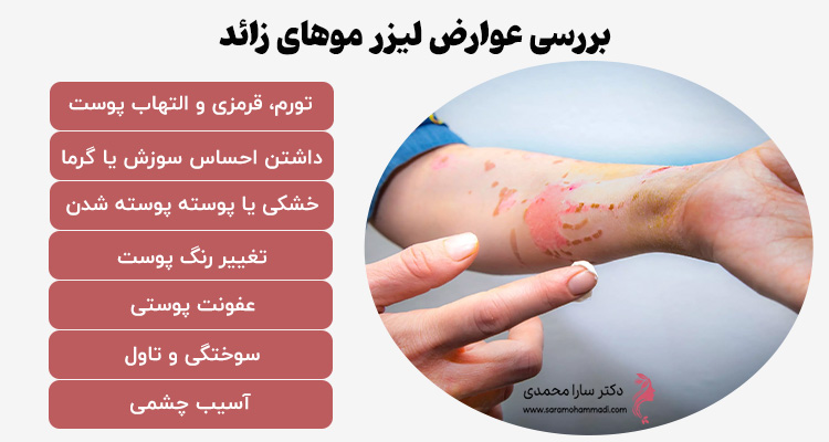بررسی عوارض لیزر موهای زائد