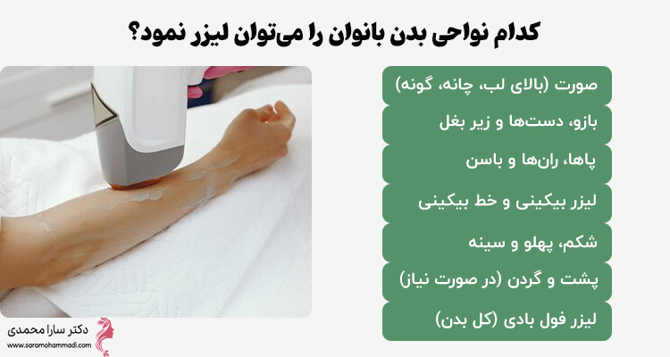 کدام نواحی بدن بانوان را می‌توان لیزر نمود؟