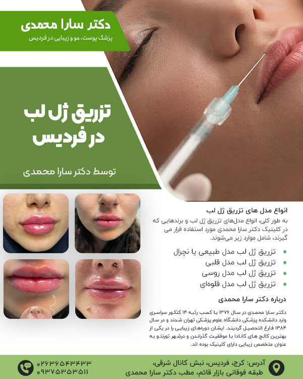 تزریق ژل لب در فردیس توسط دکتر سارا محمدی