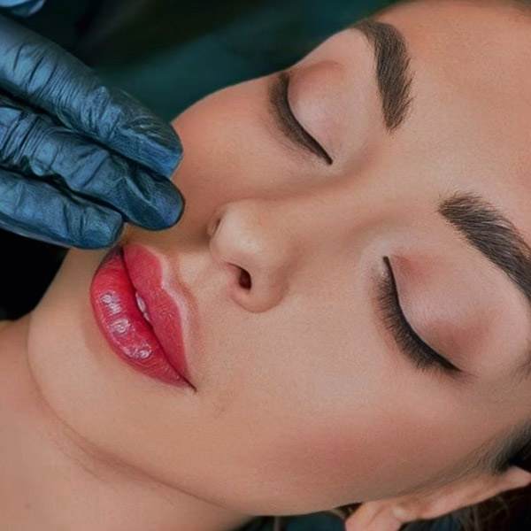 نمونه کار تزریق ژل لب مدل فانتزی در فردیس دکتر سارا محمدی