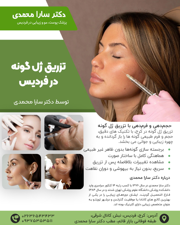 تزریق ژل گونه در کرج