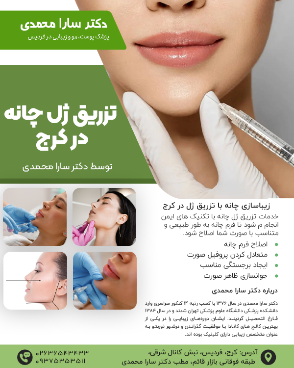 تزریق ژل چانه در کرج