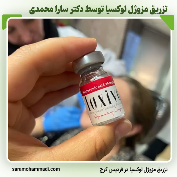 هزینه تزریق مزوژل در کرج