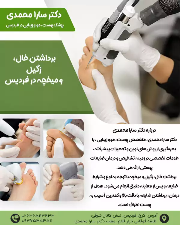 برداشتن خال در فردیس