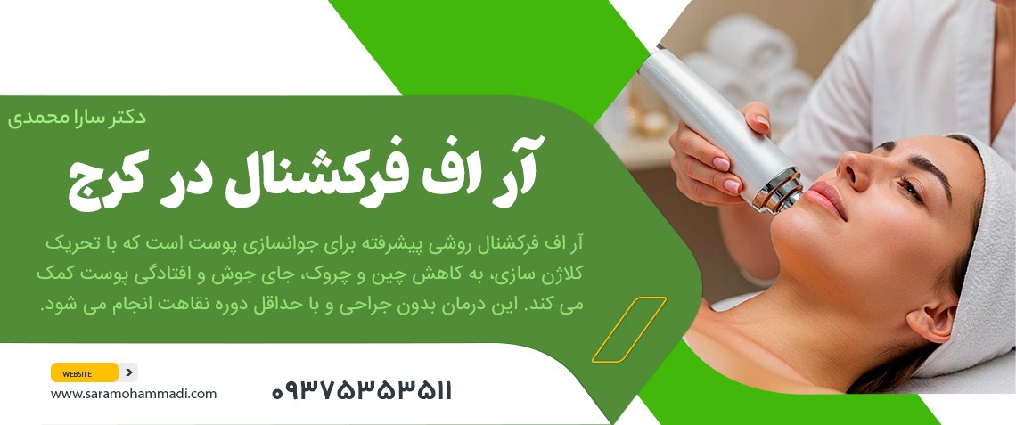 آر اف فرکشنال در کرج