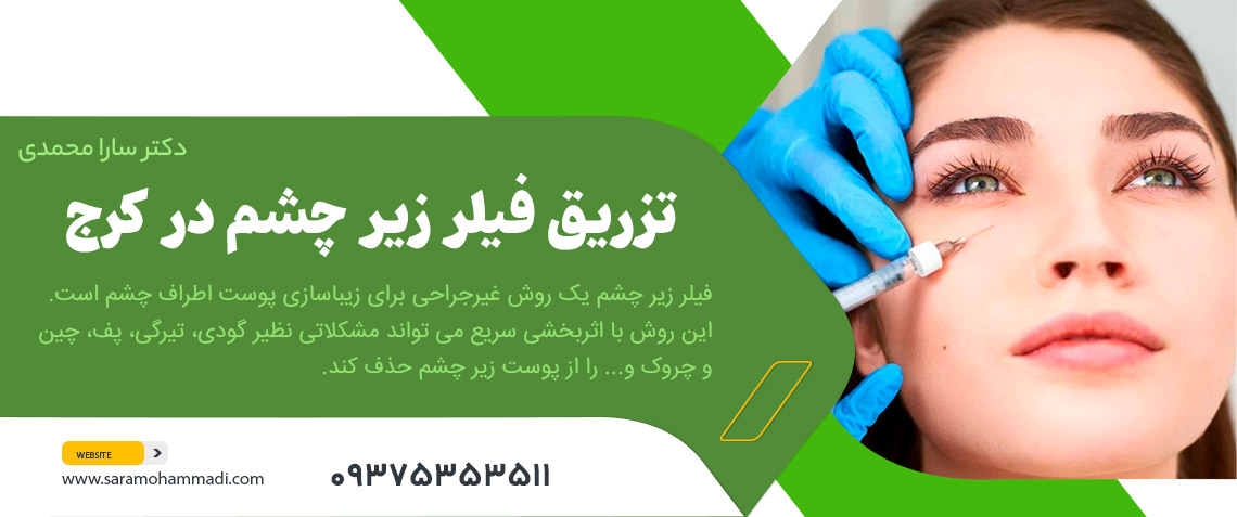 تزریق فیلر زیر چشم در کرج