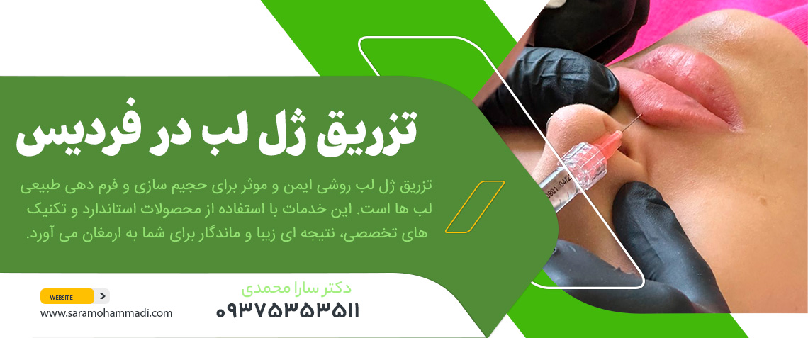 تزریق ژل لب در فردیس