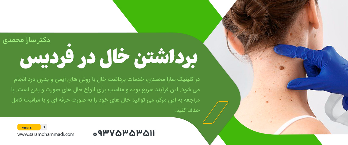 برداشتن خال در فردیس