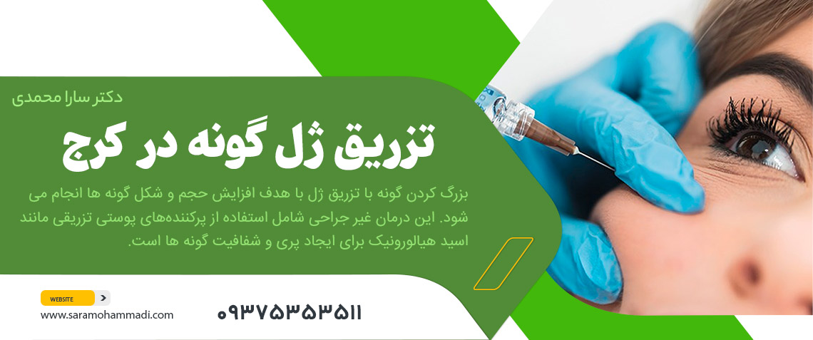تزریق ژل گونه در کرج