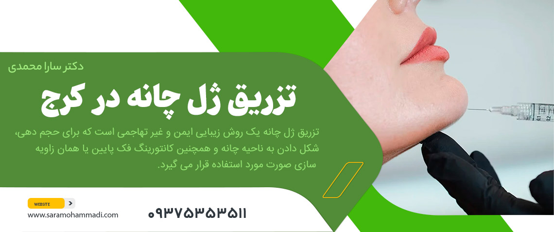 تزریق ژل چانه در کرج