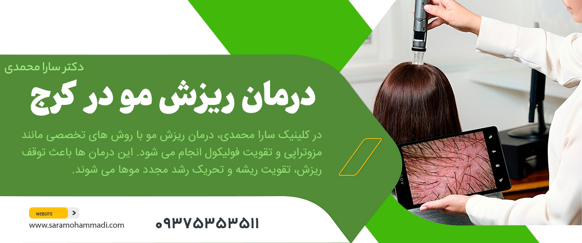 درمان ریزش مو در کرج