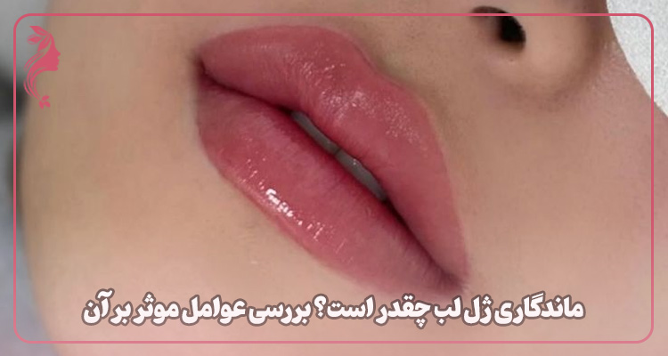 ماندگاری ژل لب