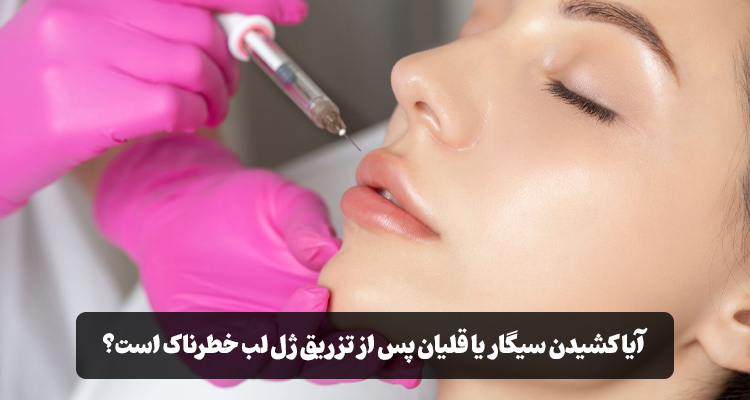 مصرف دخانیات پس از تزریق ژل لب