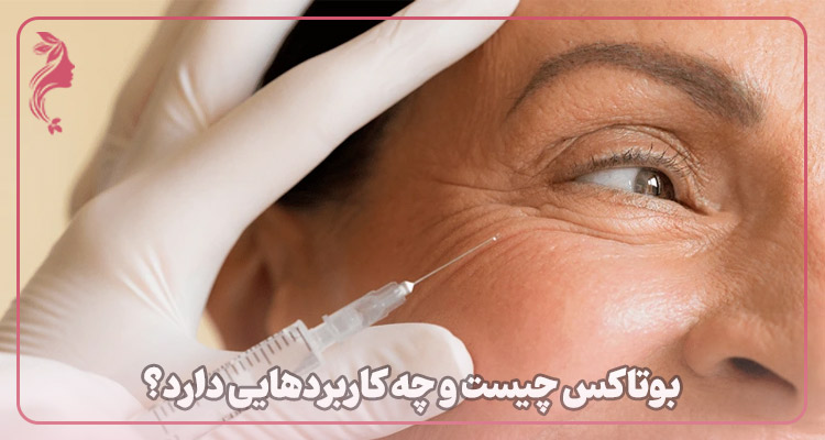 بوتاکس چیست
