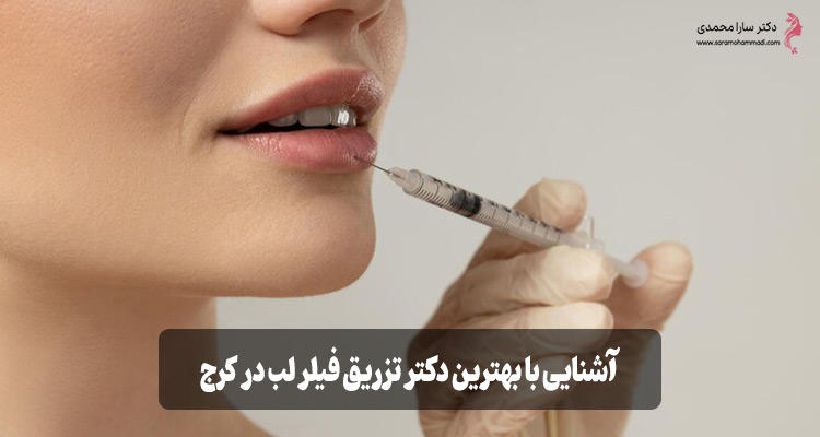 بهترین دکتر تزریق فیلر لب در کرج
