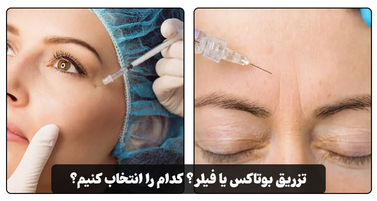 تفاوت بوتاکس و فیلر