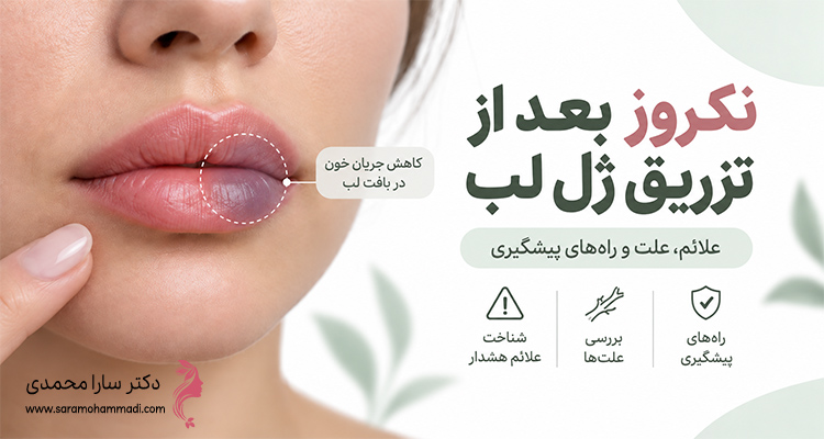 نکروز بعد از تزریق ژل لب؛ علت، علائم، درمان و راه‌های پیشگیری