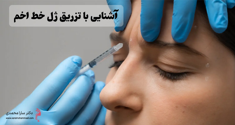تزریق ژل خط اخم