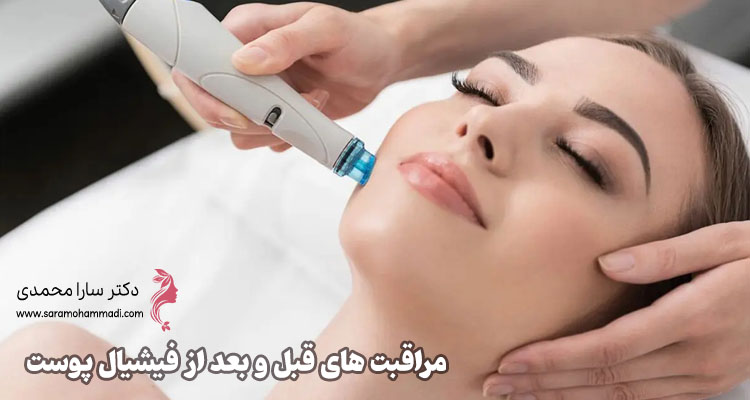 مراقبت‌ های قبل و بعد از فیشیال پوست