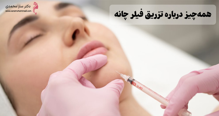 تزریق فیلر چانه