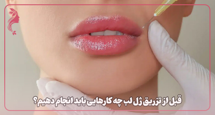 مراقبت‌های قبل از تزریق ژل لب