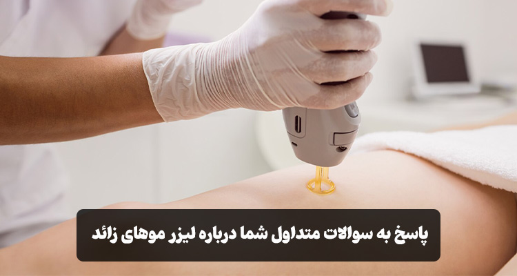 سوالات متداول لیزر موهای زائد