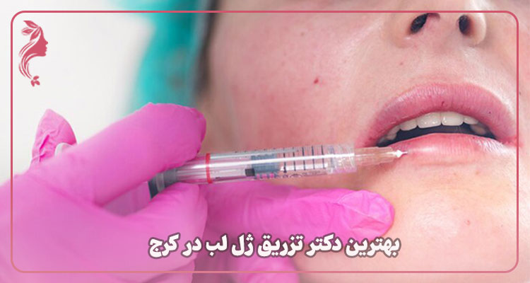 بهترین دکتر تزریق ژل و فیلر لب در کرج