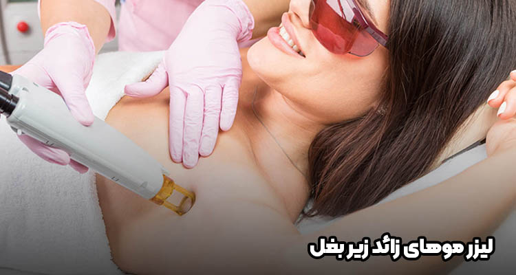 لیزر موهای زائد زیر بغل | مراحل، عوارض و تعداد جلسات