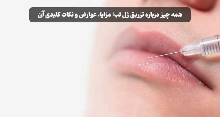 تزریق ژل لب چیست