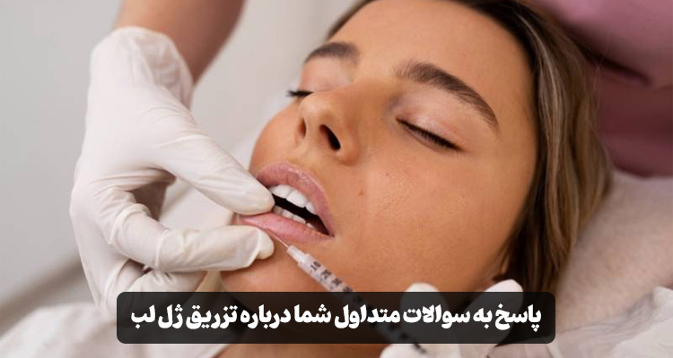 سوالات متداول تزریق ژل لب