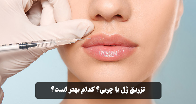 آشنایی کامل با تفاوت‌های تزریق ژل و چربی