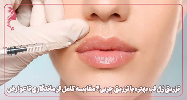 تزریق ژل لب یا تزریق چربی؟