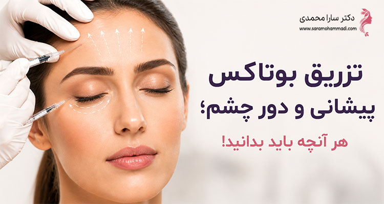 تزریق بوتاکس پیشانی و دور چشم؛ هر آنچه باید بدانید!